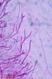 Calocera viscosa (fragmobasidis)
