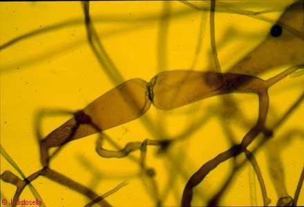 Syzygites sp. (septe de fusió)