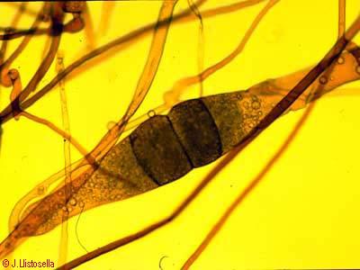 Syzygites sp. (progametangis)