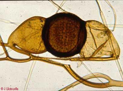 Syzygites sp. (zigòspora)